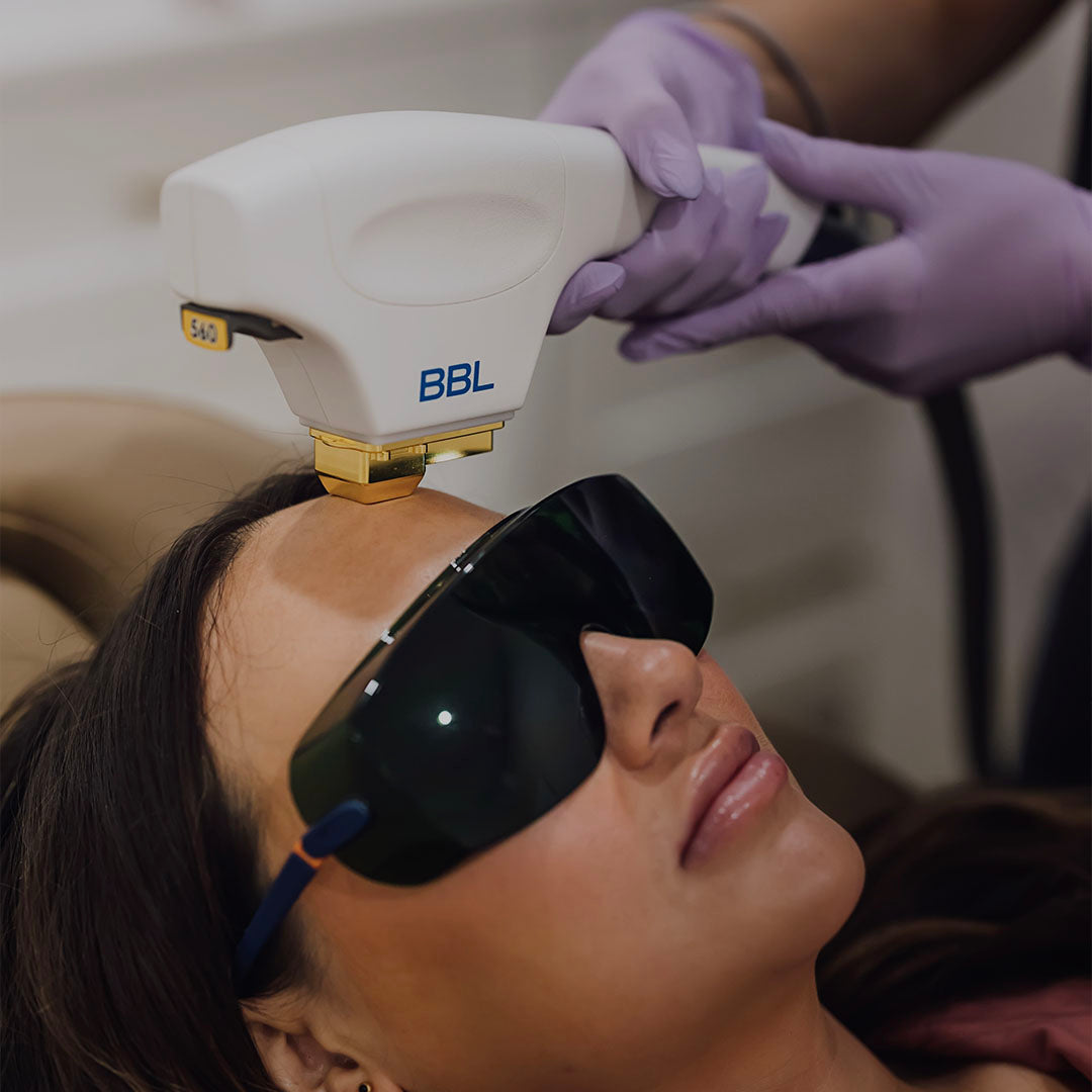 woman receiving forever young bbl photofacial performed at Skin Design Aesthetics Medical spa in South Shore, MA