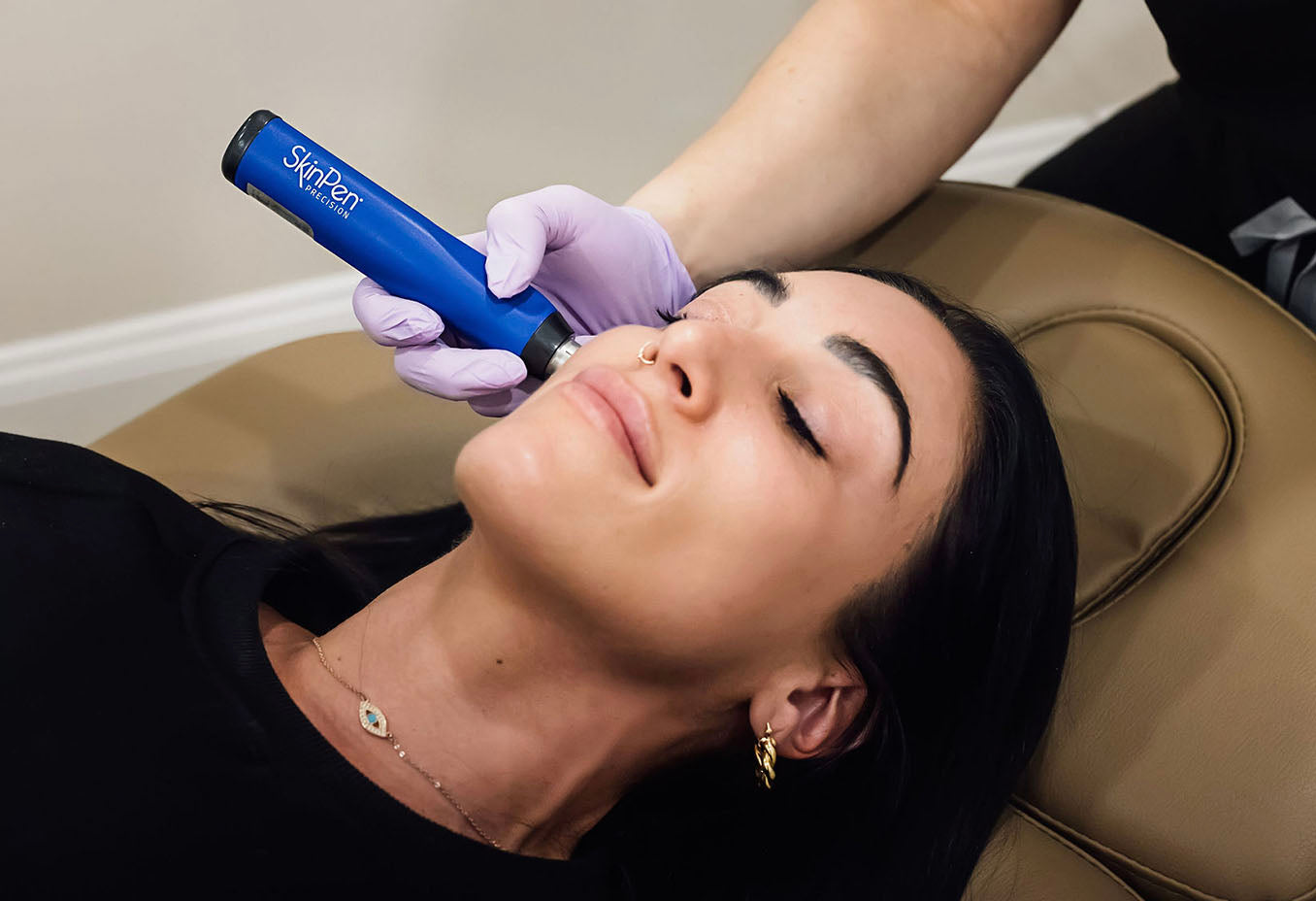 woman receiving skinpen microneedling treatment performed at Skin Design Aesthetics Medical spa in South Shore, MA
