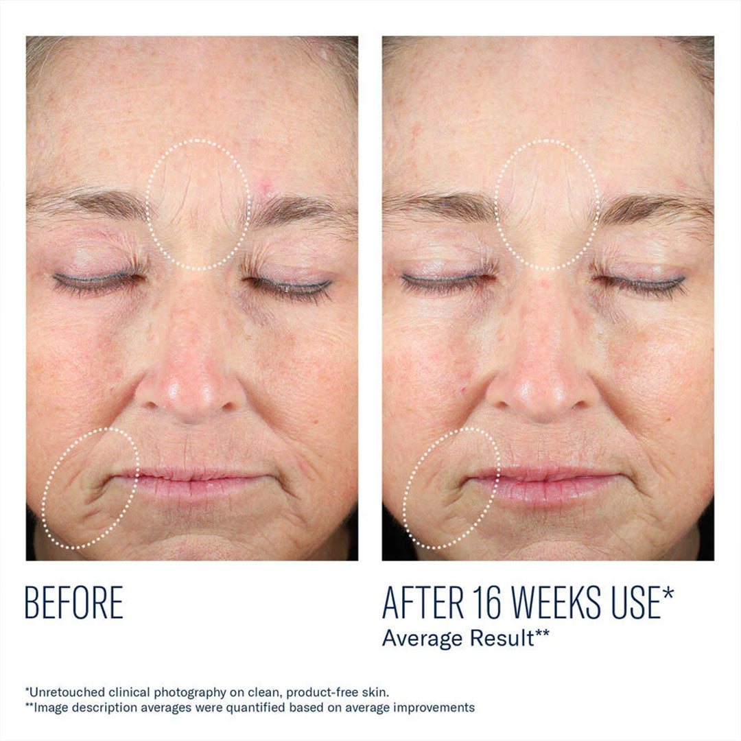 Mystro Revive Renewing Serum-Targeted Treatments-SkinBetter-Skin Design MA