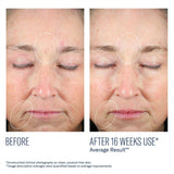 Mystro Revive Renewing Serum-Targeted Treatments-SkinBetter-Skin Design MA