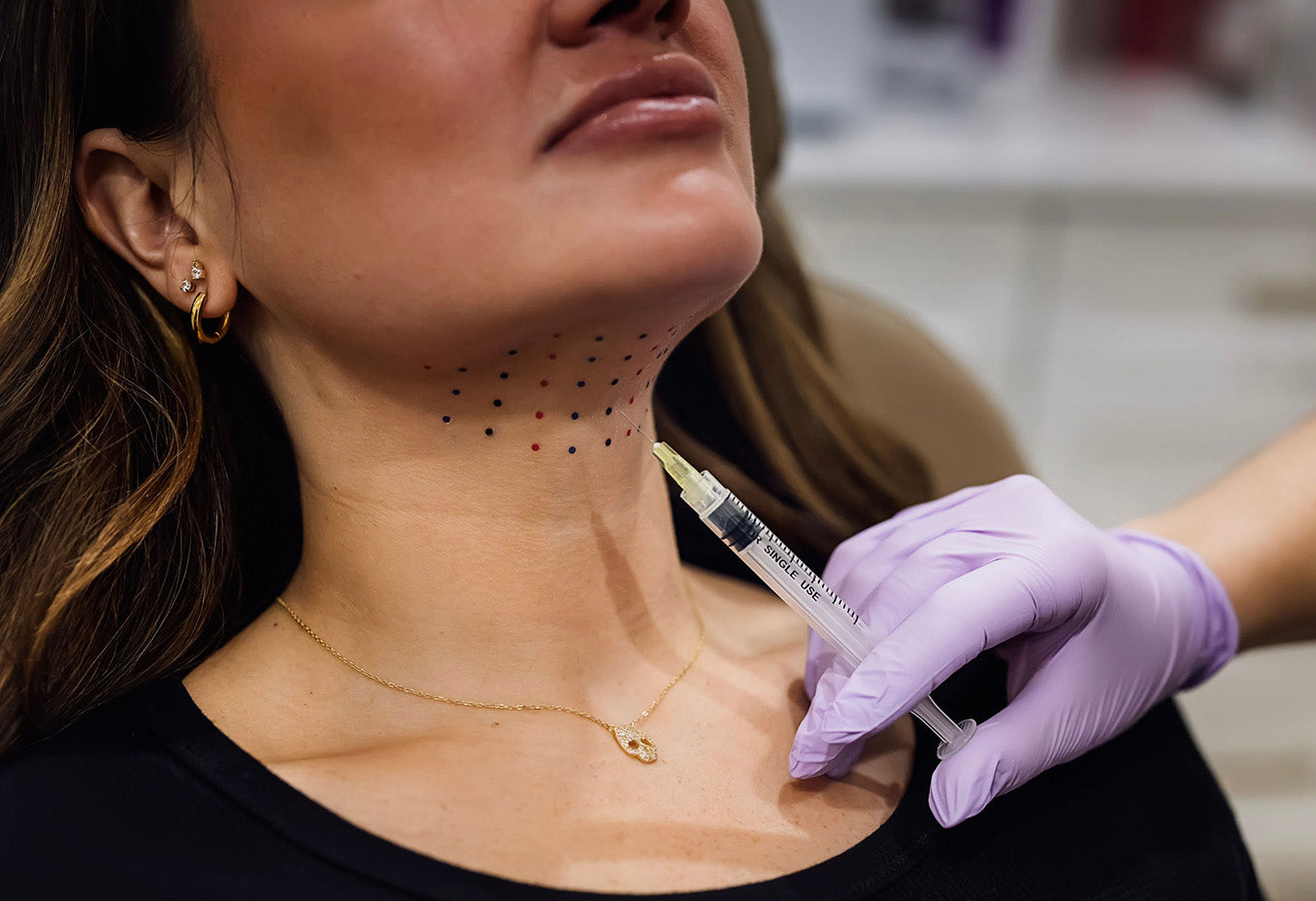 kybella double chin dissolving injections at skin design aesthetics pembroke, ma