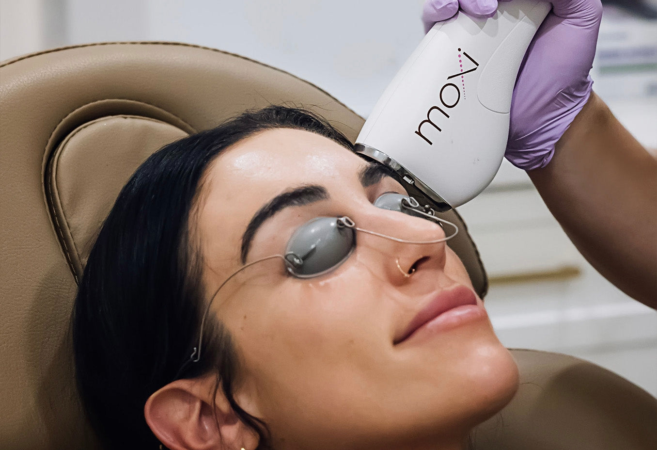 Moxi Laser Treatment Skin Design Aesthetics Med Spa in South